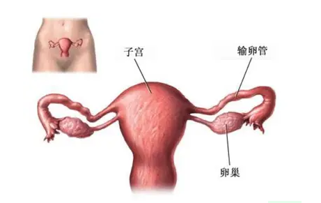 福州正规捐卵：输卵管碘油造影的助孕作用